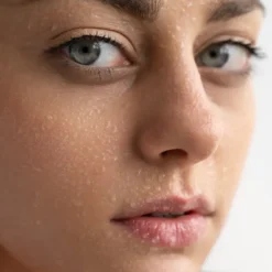 Oily Skin
