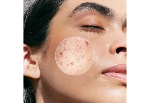 AHA + BHA Exfoliator 30ml - Image 3